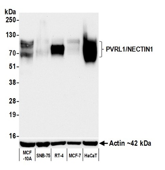 PVRL1/NECTIN1 Antibody 抗体，orb1