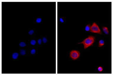 Rat Anti-Mouse IgG2b antibody 