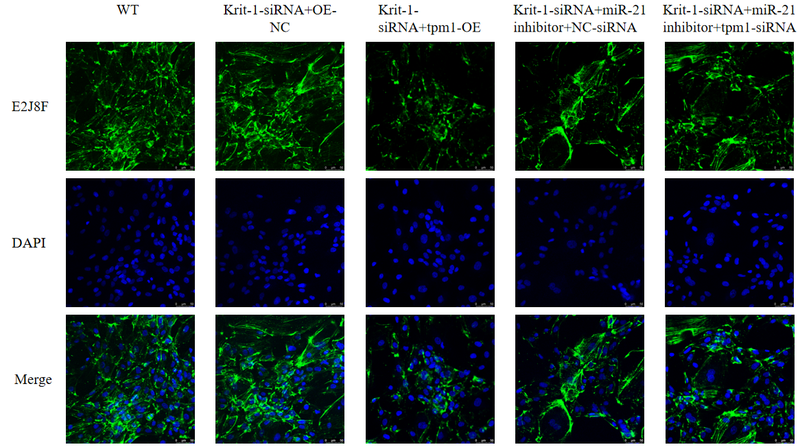 IF免疫荧光检测| 免疫荧光染色实验| 细胞免疫荧光标记