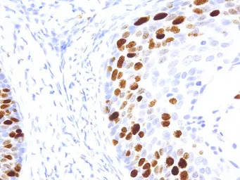 Ki67 antibody [IHC067]