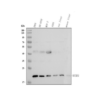 Anti-NUCKS1 Antibody 抗体，orb178