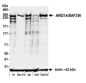 ARID1A/BAF250 Antibody 抗体，orb1