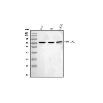 Anti-MSLNL Antibody 抗体，orb1786