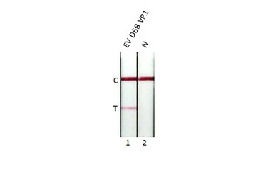 Enterovirus D68 VP1 antibody [