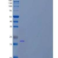 人白介素9/细胞因子P40(IL9)重组蛋白C-6His