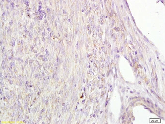 Alpha fetoprotein / AFP antibo