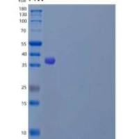 人LAMP1/CD107a重组蛋白C-6His