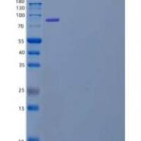 人二肽基肽酶3(DPP3)重组蛋白N-6His