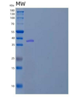 人膜联蛋白A1(ANXA1)重组蛋白