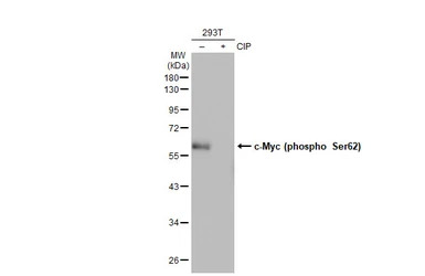 c-Myc (phospho Ser62) antibody