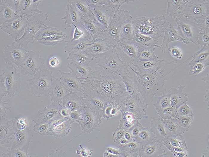 SNU-182细胞图片