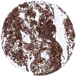 Desmin antibody [MSVA-651M] Hi