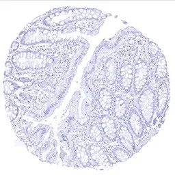 Thyroglobulin antibody [MSVA-1