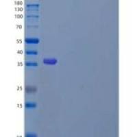 小鼠血小板生成素/THPO/TPO重组蛋白C-6His