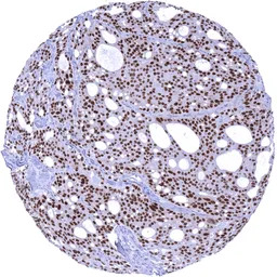 Androgen Receptor antibody [MS