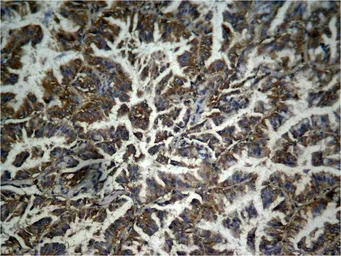 beta Catenin (phospho Tyr333) 