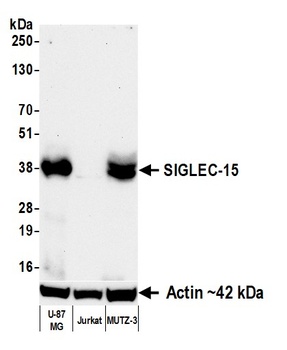 SIGLEC-15 Antibody 抗体，orb18064