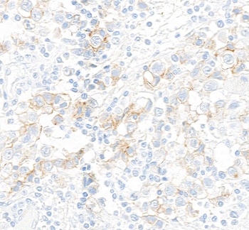 c-Kit Antibody 抗体，orb1733238，B