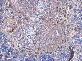 VAV1 antibody [GT557]