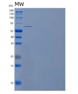 人含缬酪肽蛋白(VCP)重组蛋白C-6His