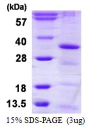 Human HAUS1 protein, His tag