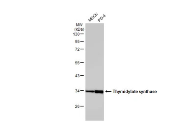 Thymidylate synthase antibody 