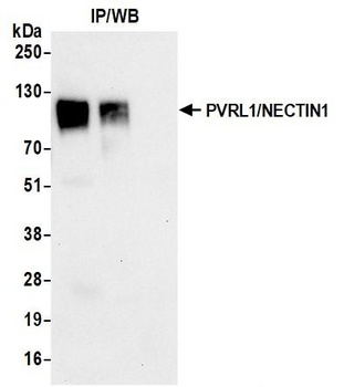 PVRL1/NECTIN1 Antibody 抗体，orb1