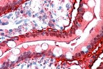 ACACB Antibody 抗体，orb1247856，B