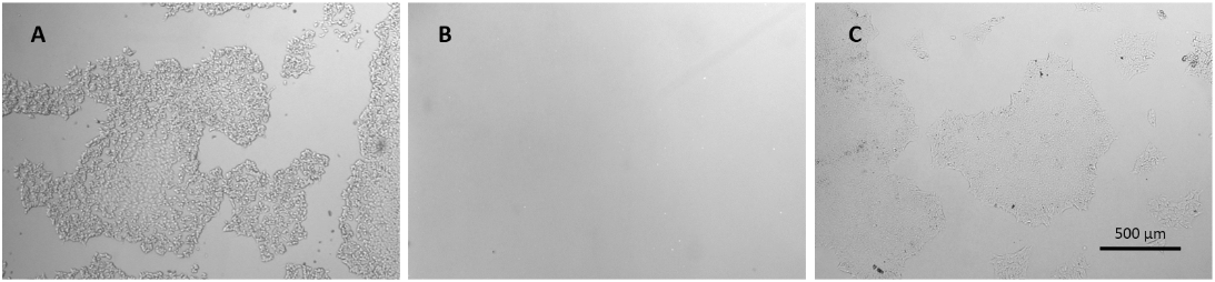 VitroGel® Organoid Recovery So