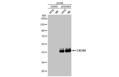 CXCR4 antibody [HL2612]