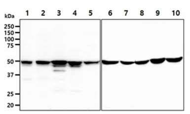 GSS antibody [AT12F2]
