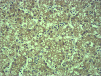 EPG5 antibody