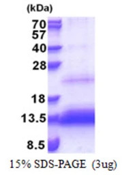 Human TRIAP1 protein, His tag