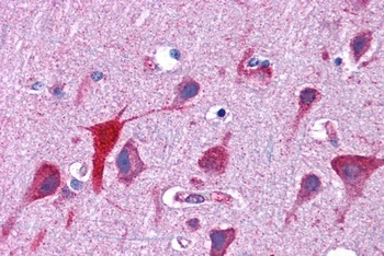 TPD52L2 Antibody 抗体，orb1247626