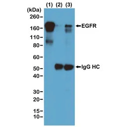 Phosphotyrosine antibody [RM11
