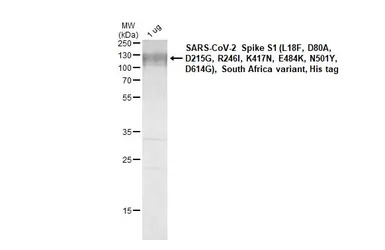 SARS-CoV-2 (COVID-19) Spike S1