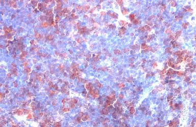 Thymidylate synthase antibody 