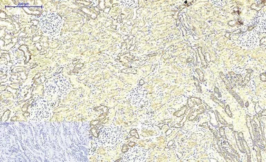 ABCB5 antibody [11A2]