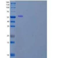 人凋亡诱导因子1线粒体/AIFM1重组蛋白N-6His