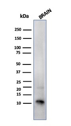 S100 beta antibody [SPM354]