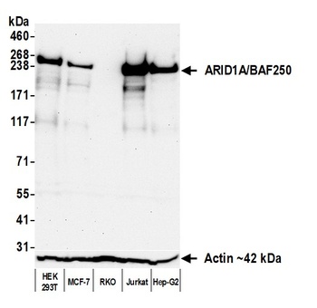 ARID1A/BAF250 Antibody 抗体，orb1