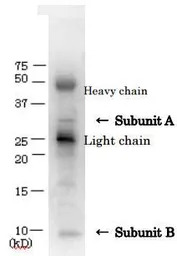 Verotoxin / Shiga toxin (SLT-1