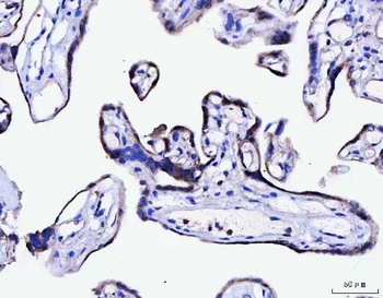 Anti-MCCC1 Antibody 抗体，orb1786
