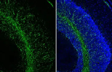 Myelin basic protein antibody 