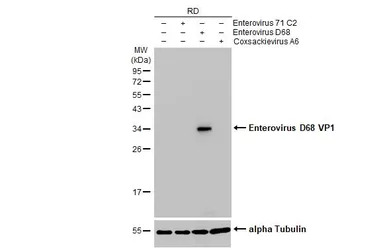 Enterovirus D68 VP1 antibody [