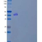 人d-β-羟基丁酸脱氢酶线粒体/BDH1重组蛋白N-6His
