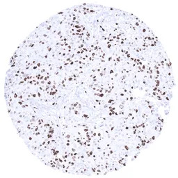 Ki67 antibody [MSVA-267M] Hist