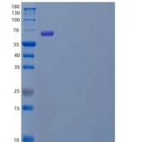 人POMGNT1重组蛋白C-6His