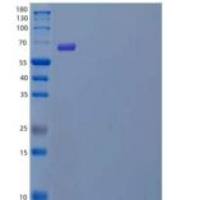 人POMGNT1重组蛋白C-6His