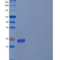 人血管生成素样蛋白8/Betatrophin(ANGPTL8)重组蛋白C-6His